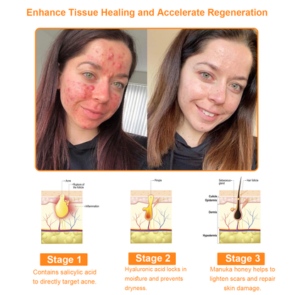 𝗧𝗟𝗢𝗣𝗔® Powerful All-Body Skin Treatment Cream (FDA Approved)💖