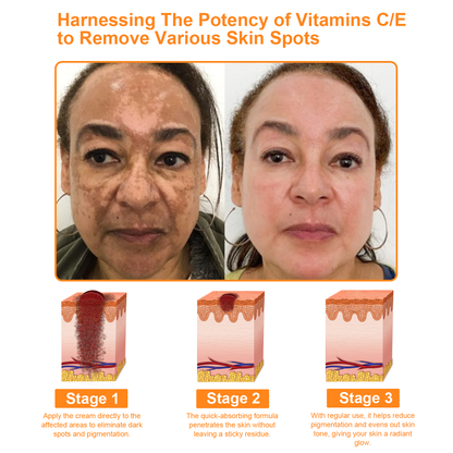 𝗧𝗟𝗢𝗣𝗔® Powerful All-Body Skin Treatment Cream (FDA Approved)💖
